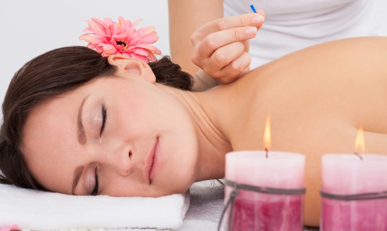 The image shows a mannequin with needles in its back. Drawings and labels of the meridian pathways used in acupuncture are visible on the mannequin.